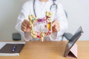 Cancro al colon, microbioma può predirne rischio e guidare diagnosi precoce