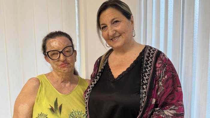 Femminicidio Rovella, Lamberti (NM): “Denunciate sempre”