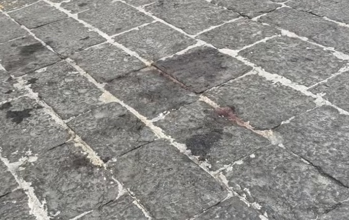 Giovane accoltellata alle spalle,  è caccia all’aggressore